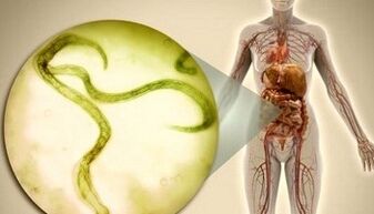 Como desfacerse dos parasitos no corpo