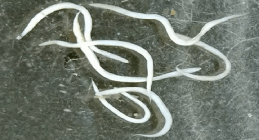 oxiuros no corpo humano