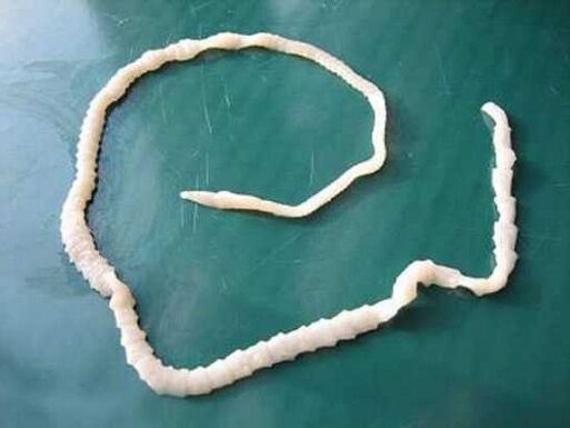 tenia humana de porco