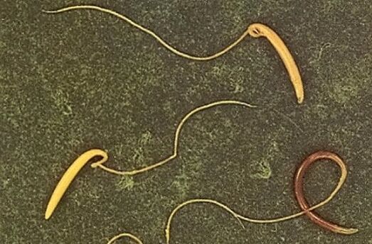 tricocéfalo do corpo humano