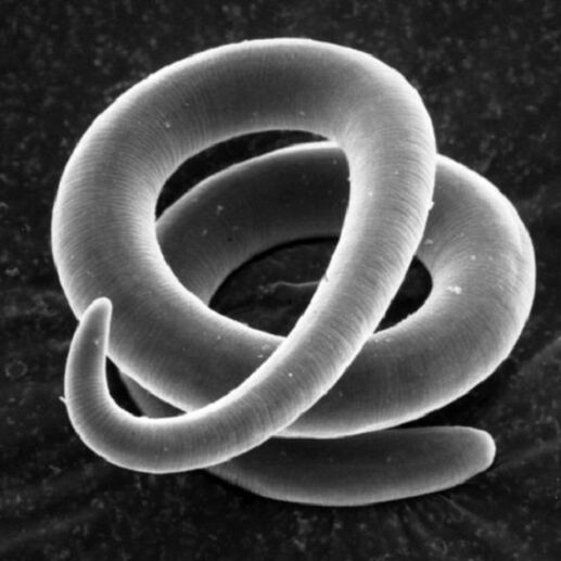 verme parasito trichinella en humanos