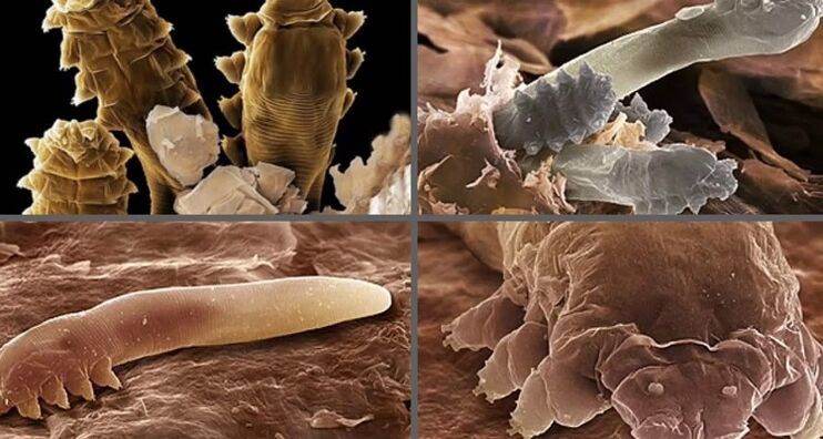 tipos de parasitos cutáneos humanos