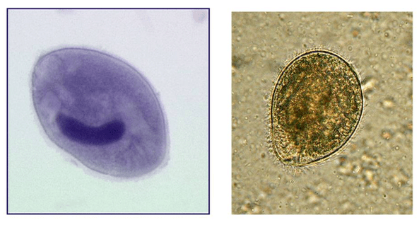 Balantidia ciliados, parasitos do intestino groso