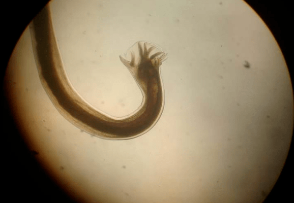 Parasito ao microscopio